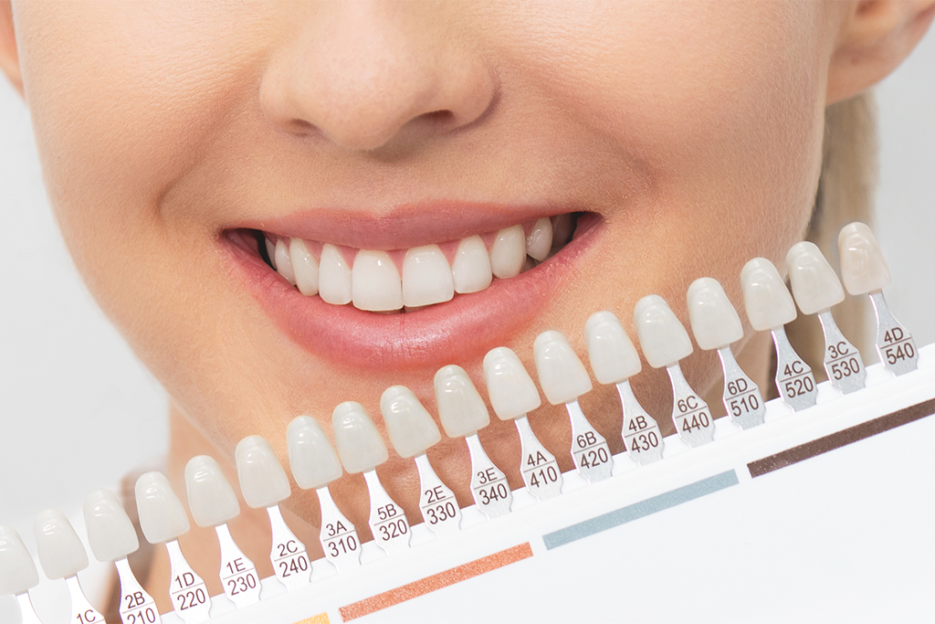 歯そのものを白くするならホワイトニング
